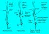 Medial Knee OA and Valgus Wedge Effect.jpg